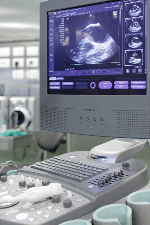 Ultrasound machine